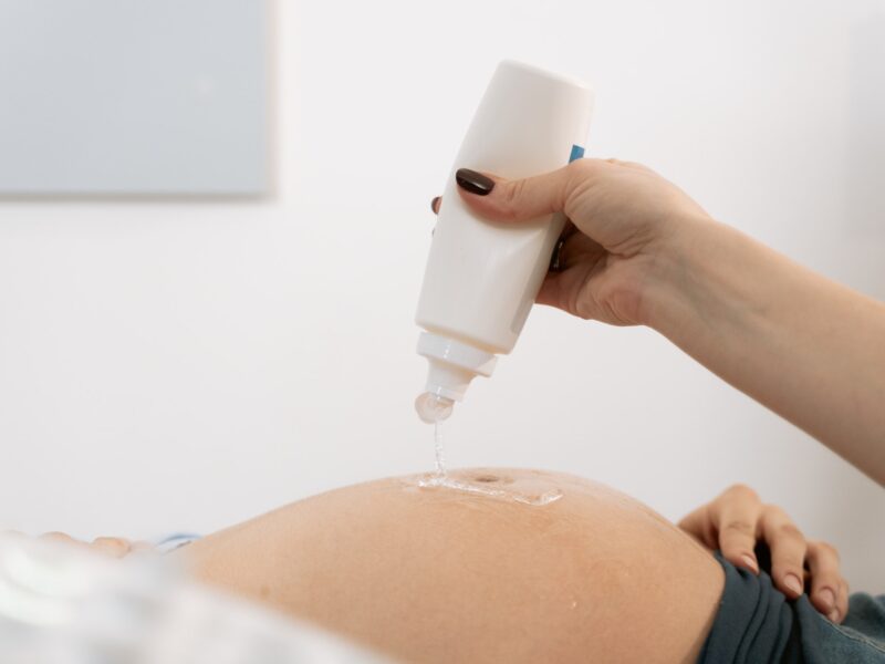 what is an obstetric ultrasound